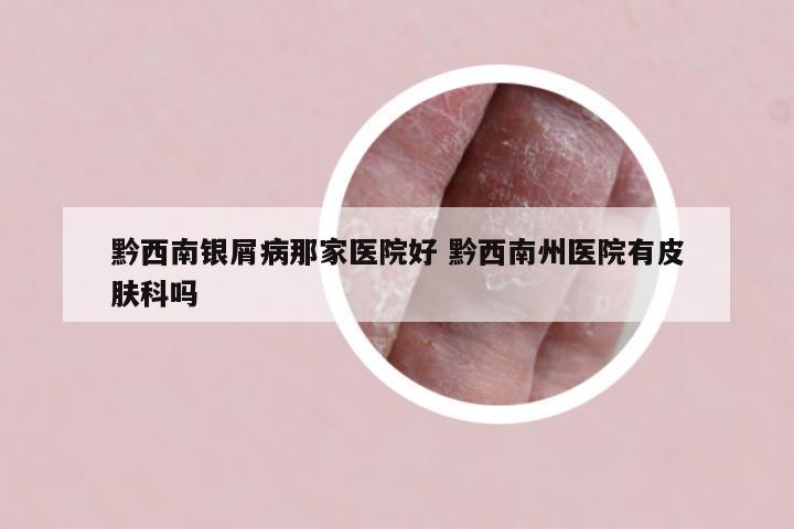 黔西南银屑病那家医院好 黔西南州医院有皮肤科吗