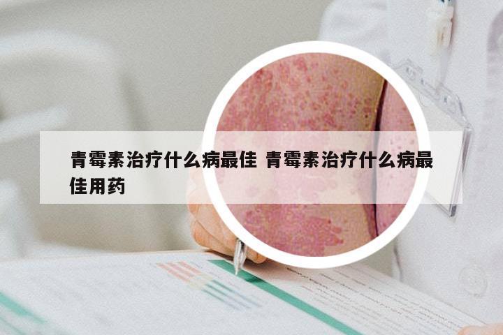 青霉素治疗什么病最佳 青霉素治疗什么病最佳用药