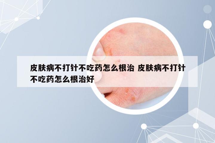 皮肤病不打针不吃药怎么根治 皮肤病不打针不吃药怎么根治好