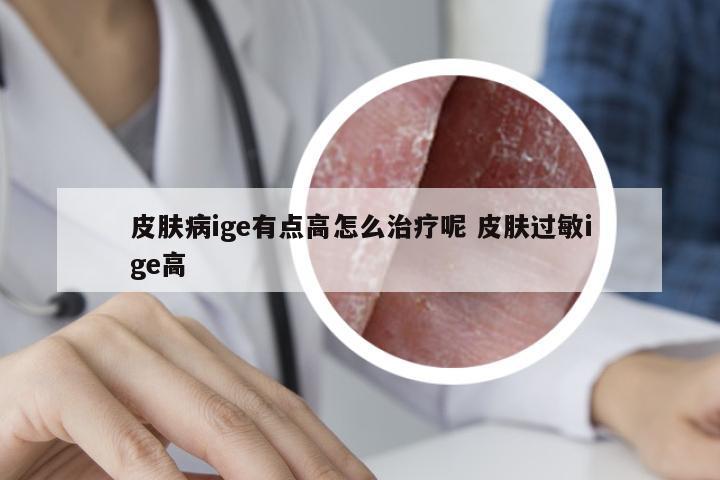 皮肤病ige有点高怎么治疗呢 皮肤过敏ige高