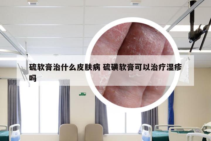 硫软膏治什么皮肤病 硫磺软膏可以治疗湿疹吗