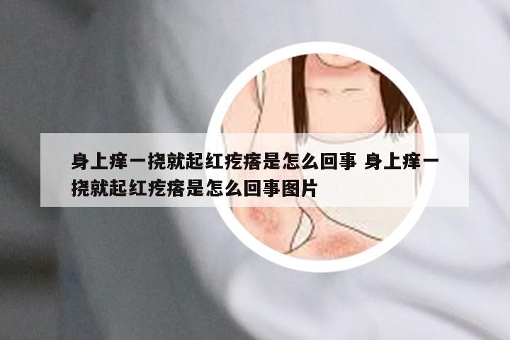 身上痒一挠就起红疙瘩是怎么回事 身上痒一挠就起红疙瘩是怎么回事图片