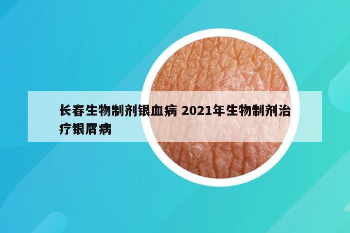 长春生物制剂银血病 2021年生物制剂治疗银屑病