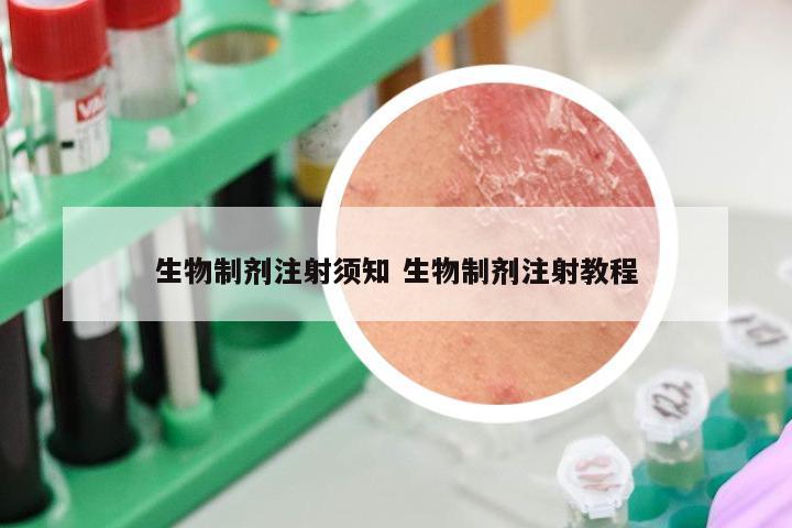 生物制剂注射须知 生物制剂注射教程