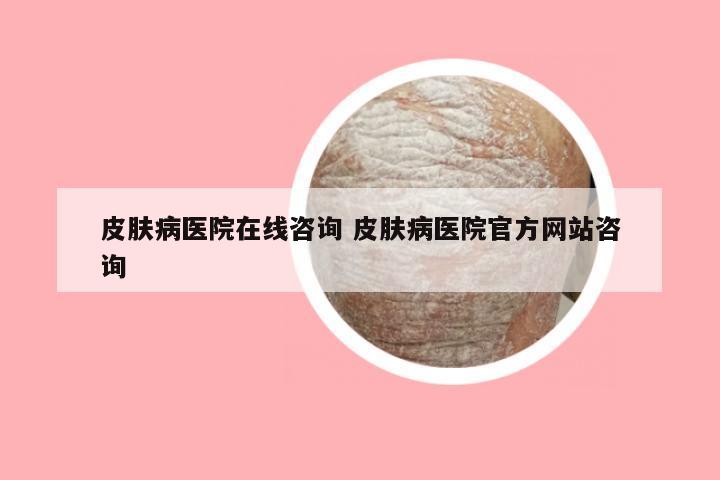 皮肤病医院在线咨询 皮肤病医院官方网站咨询