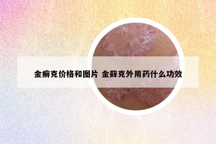 金癣克价格和图片 金藓克外用药什么功效