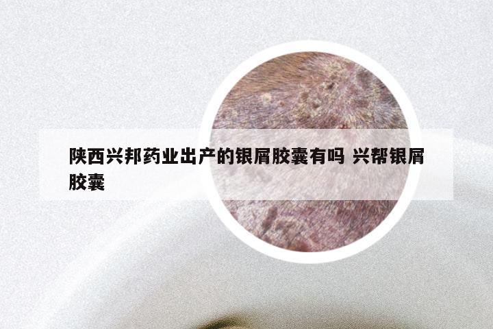 陕西兴邦药业出产的银屑胶囊有吗 兴帮银屑胶囊