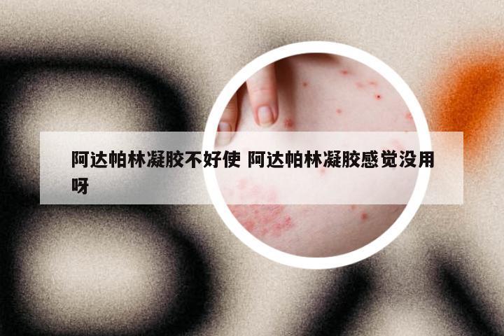 阿达帕林凝胶不好使 阿达帕林凝胶感觉没用呀