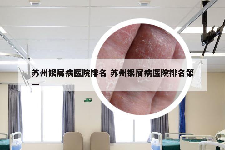 苏州银屑病医院排名 苏州银屑病医院排名第一