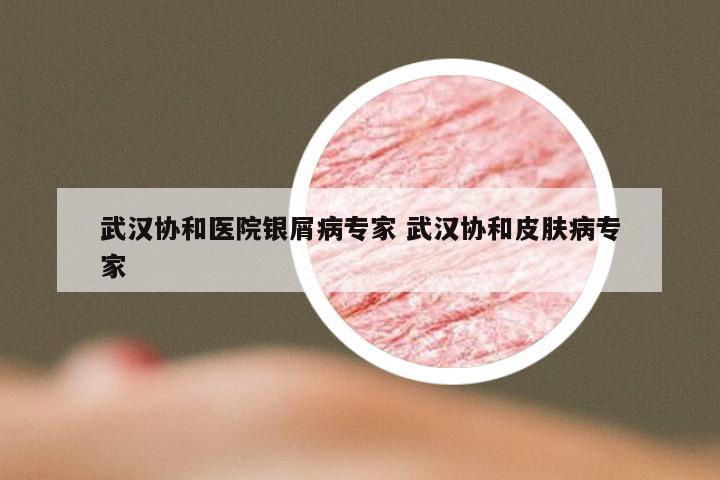 武汉协和医院银屑病专家 武汉协和皮肤病专家