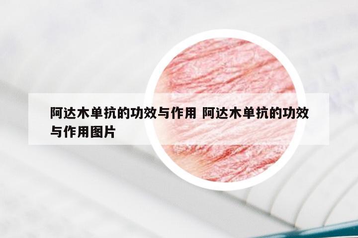 阿达木单抗的功效与作用 阿达木单抗的功效与作用图片