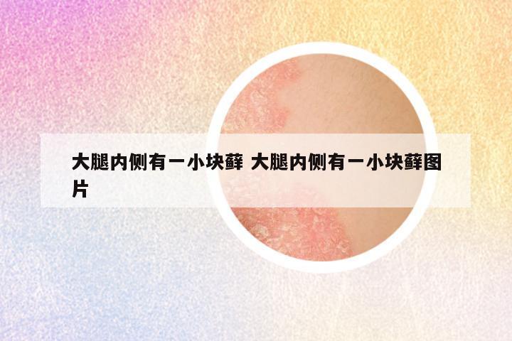 大腿内侧有一小块藓 大腿内侧有一小块藓图片