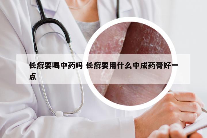 长癣要喝中药吗 长癣要用什么中成药膏好一点