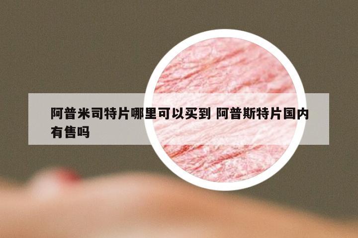 阿普米司特片哪里可以买到 阿普斯特片国内有售吗