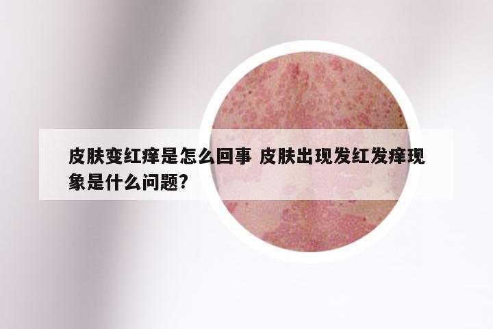 皮肤变红痒是怎么回事 皮肤出现发红发痒现象是什么问题?