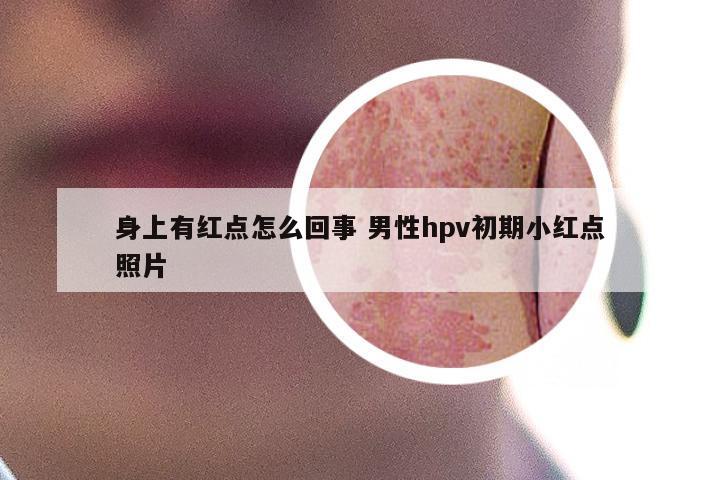 身上有红点怎么回事 男性hpv初期小红点照片