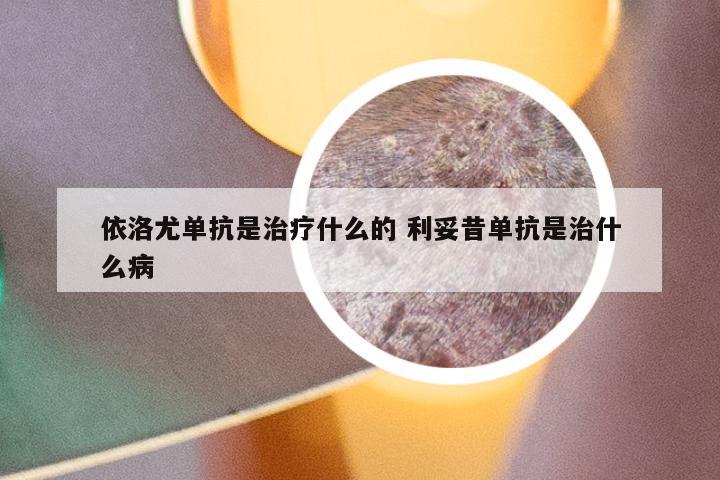 依洛尤单抗是治疗什么的 利妥昔单抗是治什么病