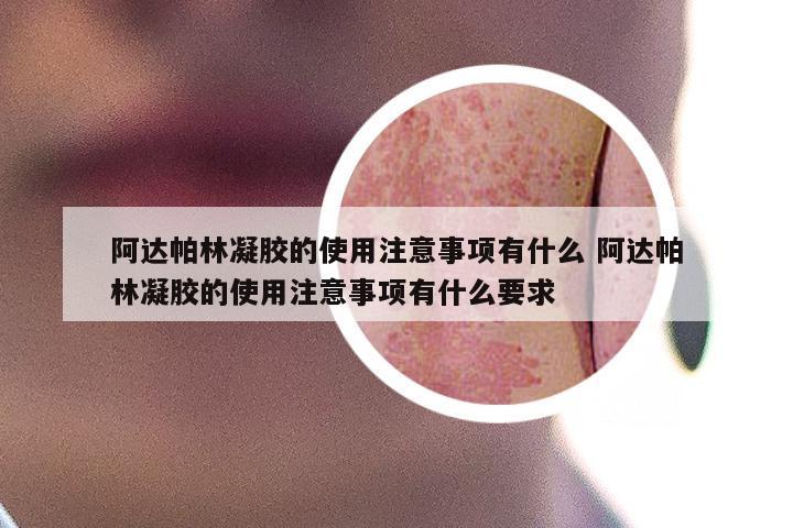 阿达帕林凝胶的使用注意事项有什么 阿达帕林凝胶的使用注意事项有什么要求