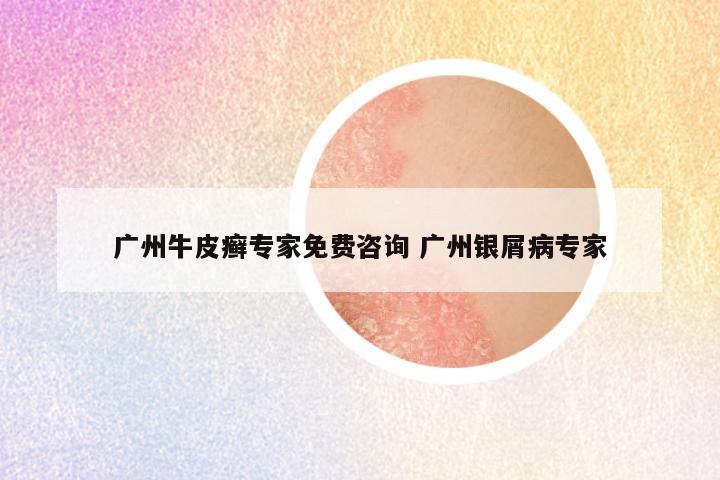 广州牛皮癣专家免费咨询 广州银屑病专家