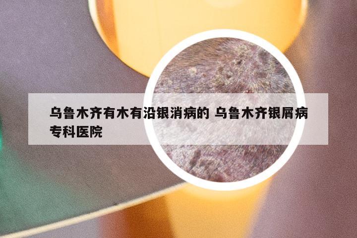 乌鲁木齐有木有沿银消病的 乌鲁木齐银屑病专科医院