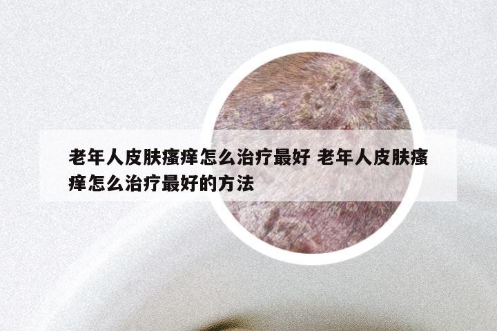 老年人皮肤瘙痒怎么治疗最好 老年人皮肤瘙痒怎么治疗最好的方法