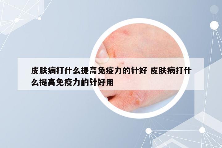 皮肤病打什么提高免疫力的针好 皮肤病打什么提高免疫力的针好用