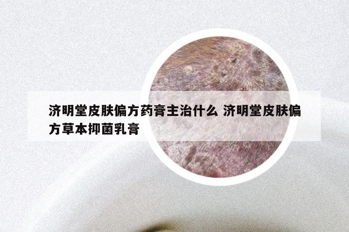 济明堂皮肤偏方药膏主治什么 济明堂皮肤偏方草本抑菌乳膏