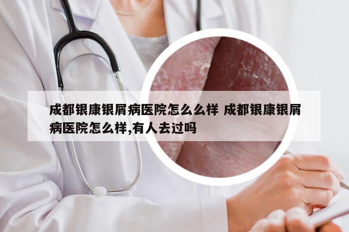 成都银康银屑病医院怎么么样 成都银康银屑病医院怎么样,有人去过吗