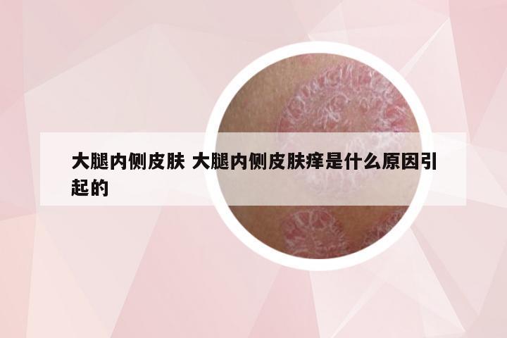 大腿内侧皮肤 大腿内侧皮肤痒是什么原因引起的