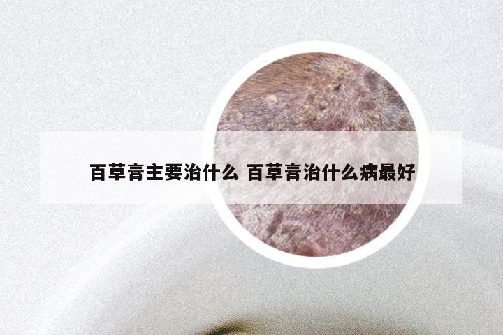 百草膏主要治什么 百草膏治什么病最好