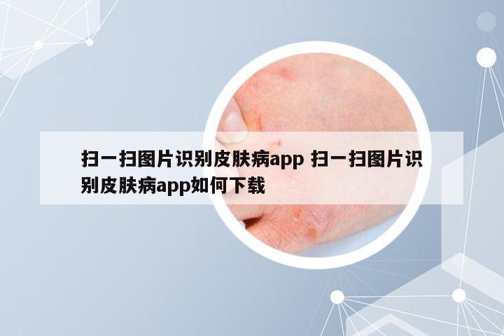 扫一扫图片识别皮肤病app 扫一扫图片识别皮肤病app如何下载