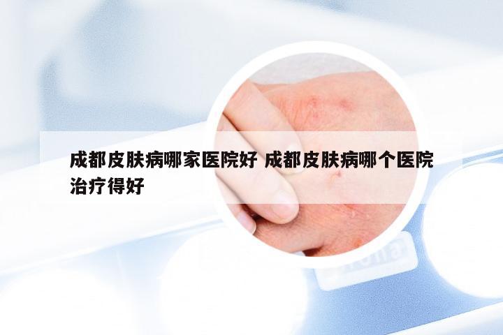 成都皮肤病哪家医院好 成都皮肤病哪个医院治疗得好