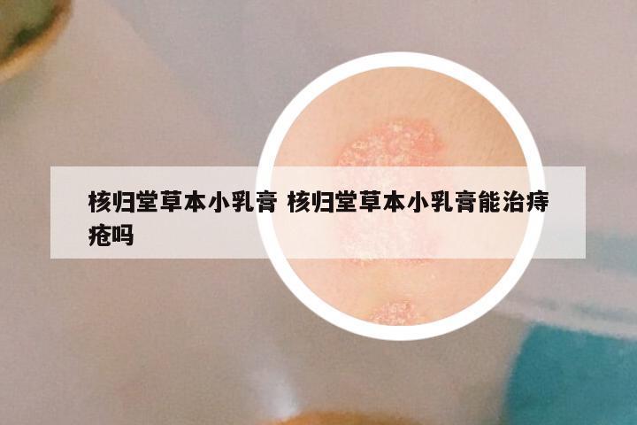 核归堂草本小乳膏 核归堂草本小乳膏能治痔疮吗