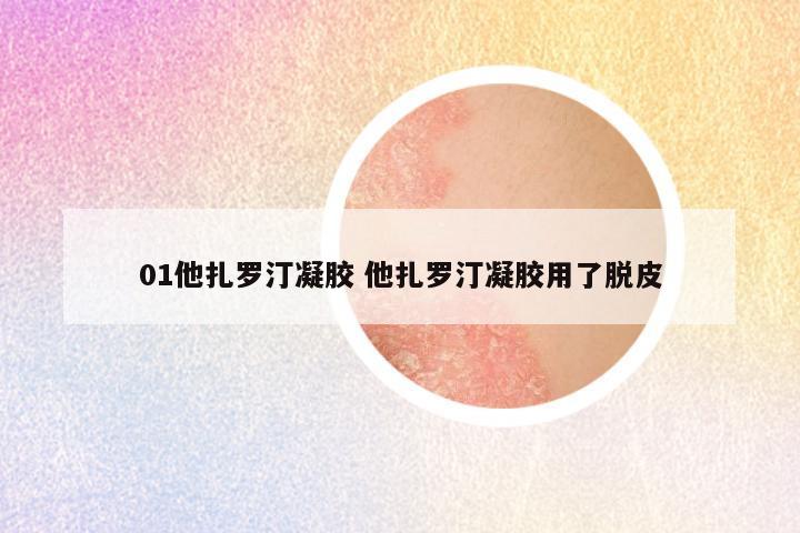 01他扎罗汀凝胶 他扎罗汀凝胶用了脱皮