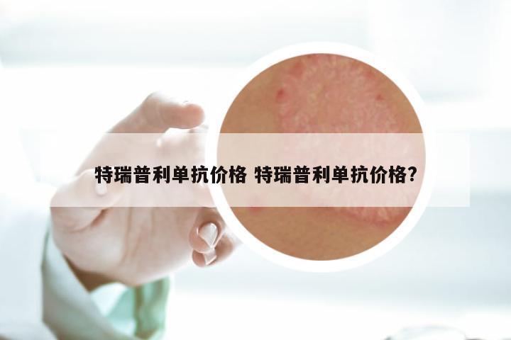 特瑞普利单抗价格 特瑞普利单抗价格?