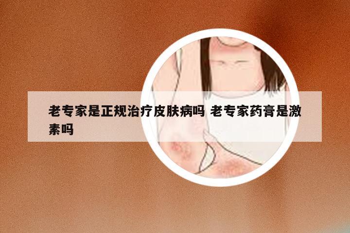 老专家是正规治疗皮肤病吗 老专家药膏是激素吗