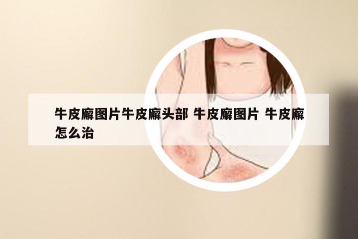 牛皮廨图片牛皮廨头部 牛皮廨图片 牛皮廨怎么治