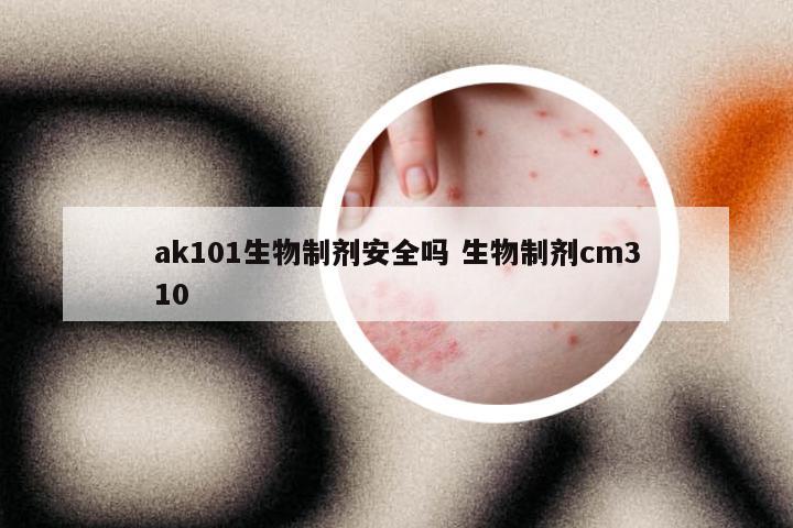 ak101生物制剂安全吗 生物制剂cm310