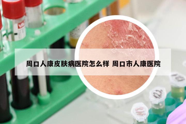 周口人康皮肤病医院怎么样 周口市人康医院