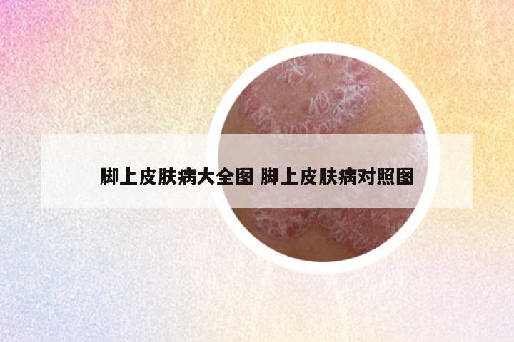 脚上皮肤病大全图 脚上皮肤病对照图