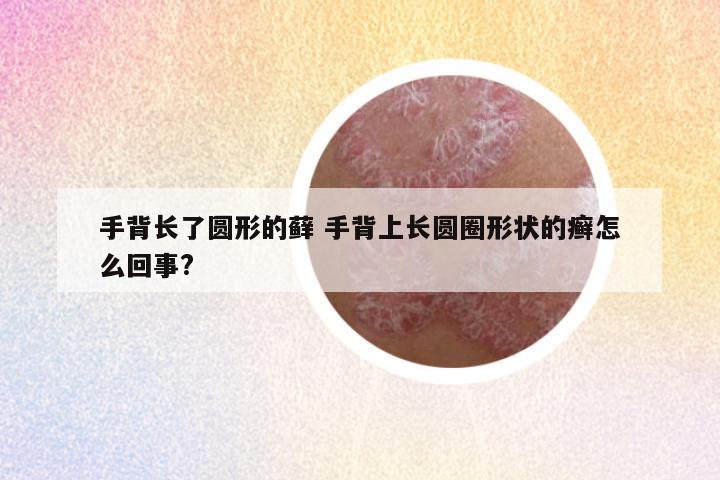 手背长了圆形的藓 手背上长圆圈形状的癣怎么回事?