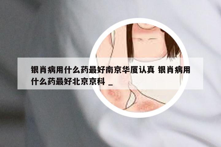 银肖病用什么药最好南京华厦认真 银肖病用什么药最好北京京科 _