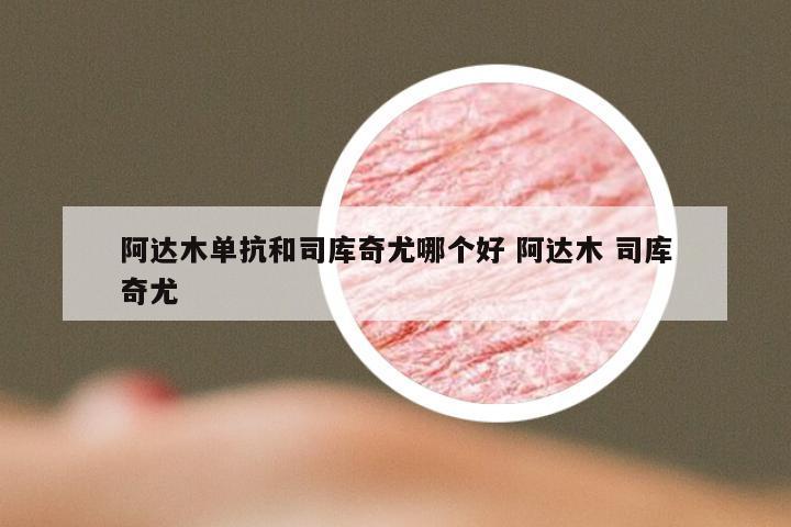 阿达木单抗和司库奇尤哪个好 阿达木 司库奇尤