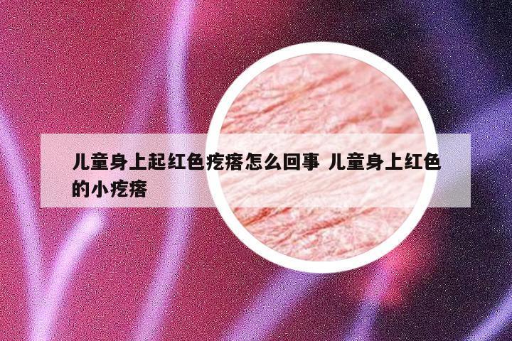 儿童身上起红色疙瘩怎么回事 儿童身上红色的小疙瘩