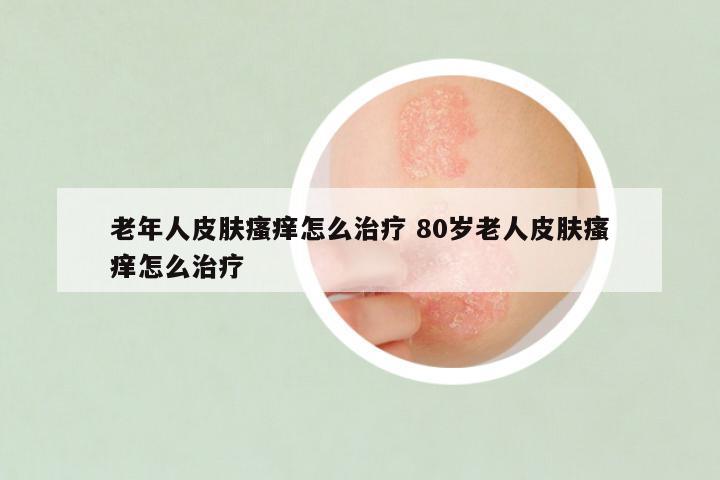 老年人皮肤瘙痒怎么治疗 80岁老人皮肤瘙痒怎么治疗