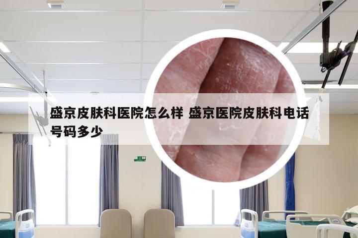 盛京皮肤科医院怎么样 盛京医院皮肤科电话号码多少