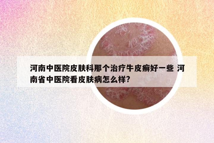 河南中医院皮肤科那个治疗牛皮癣好一些 河南省中医院看皮肤病怎么样?