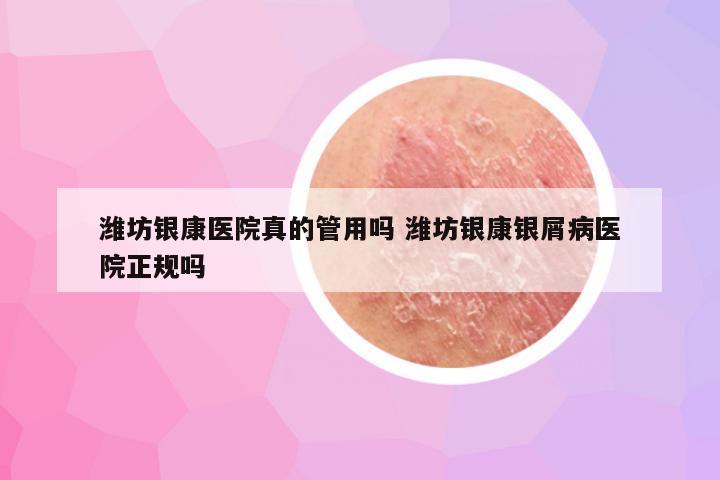 潍坊银康医院真的管用吗 潍坊银康银屑病医院正规吗