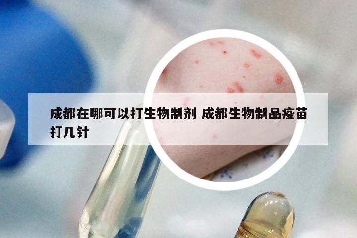 成都在哪可以打生物制剂 成都生物制品疫苗打几针