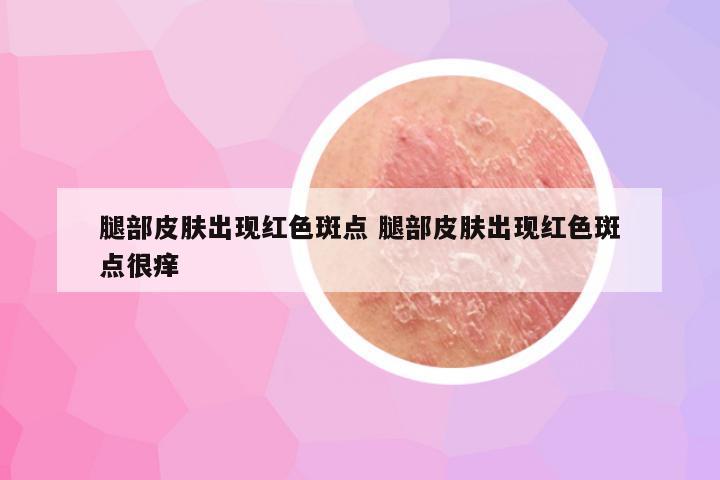 腿部皮肤出现红色斑点 腿部皮肤出现红色斑点很痒